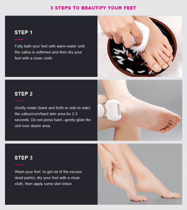 Electric Foot Callus Hard and Dead Skin Remover - Image 7